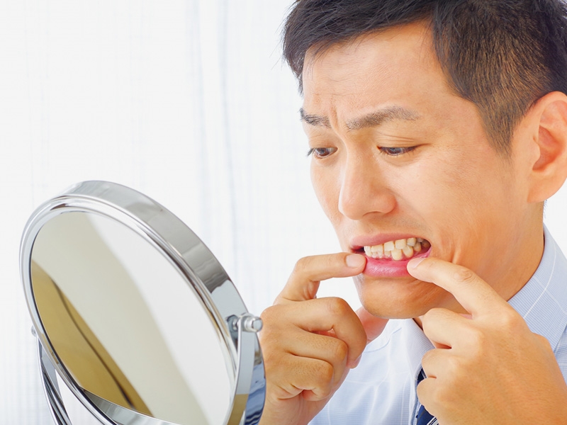 歯周病予防は認知症予防